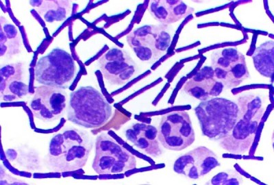 mikroskopie,Gram_Anthrax.jpg